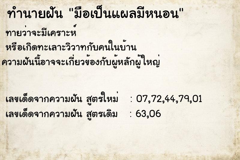 ทำนายฝัน มือเป็นแผลมีหนอน แม่นๆ ฟรี ด้วยตำราหนังสือทำนายฝันโบราณ ทำนายฝันมือเป็นแผลมีหนอน