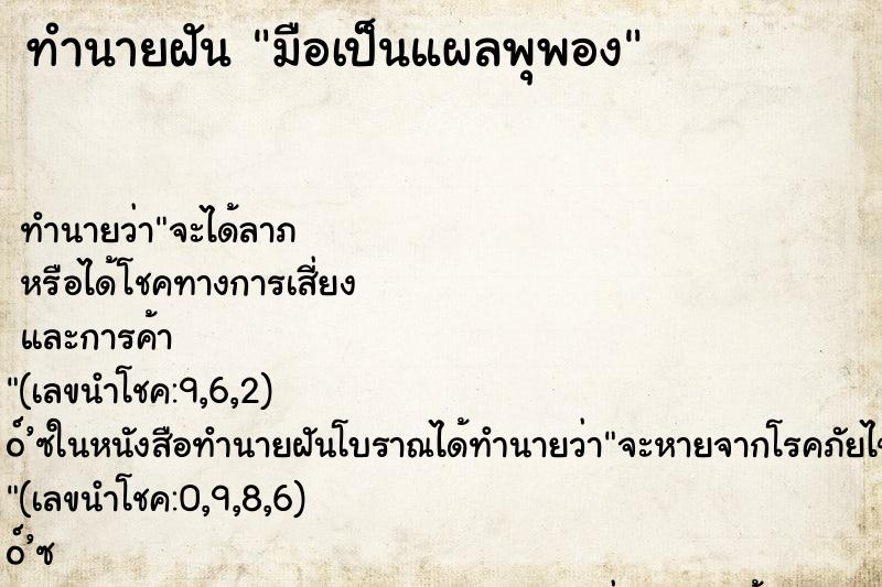 ทำนายฝัน มือเป็นแผลพุพอง ทำนายฝัน มือเป็นแผลพุพอง