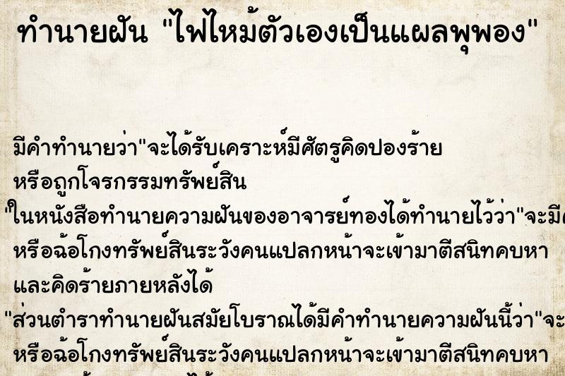 ทำนายฝัน ไฟไหม้ตัวเองเป็นแผลพุพอง
