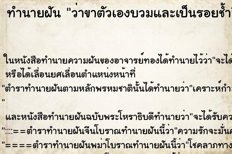 ทำนายฝัน ว่าขาตัวเองบวมและเป็นรอยช้ำสีเขียวเป็นป้านเลย