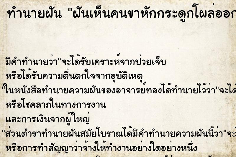 ทำนายฝัน ฝันเห็นคนขาหักกระดูกโผล่ออกมา ทำนายฝัน ฝันเห็นคนขาหักกระดูกโผล่ออกมา