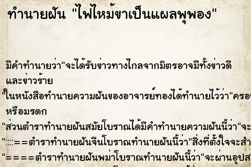 ทำนายฝันไฟไหม้ขาเป็นแผลพุพอง ทำนายฝันทำนายฝันไฟไหม้ขาเป็นแผลพุพอง