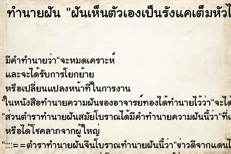 ทำนายฝัน ฝันเห็นตัวเองเป็นรังแคเต็มหัวไปหมด ทำนายฝัน ฝันเห็นตัวเองเป็นรังแคเต็มหัวไปหมด