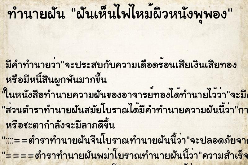 ทำนายฝันฝันเห็นไฟไหม้ผิวหนังพุพอง ทำนายฝันทำนายฝันฝันเห็นไฟไหม้ผิวหนังพุพอง