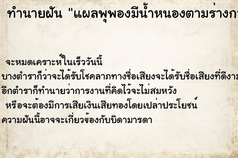 ทำนายฝันทำนายฝันแผลพุพองมีน้ำหนองตามร่างกาย