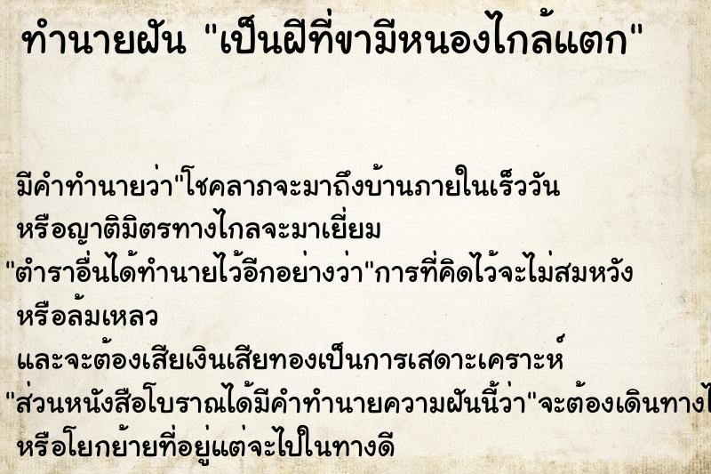 ทำนายฝัน เป็นฝีที่ขามีหนองไกล้แตก ทำนายฝัน เป็นฝีที่ขามีหนองไกล้แตก