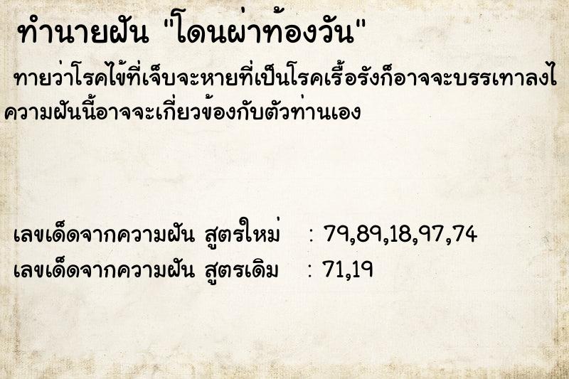 ทำนายฝันทำนายฝันโดนผ่าท้องวัน