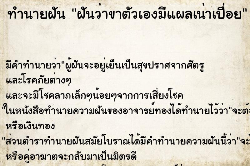 ทำนายฝันฝันว่าขาตัวเองมีแผลเน่าเปื่อย ทำนายฝันทำนายฝันฝันว่าขาตัวเองมีแผลเน่าเปื่อย