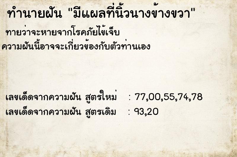 ทำนายฝัน มีแผลที่นิ้วนางข้างขวา ทำนายฝัน มีแผลที่นิ้วนางข้างขวา