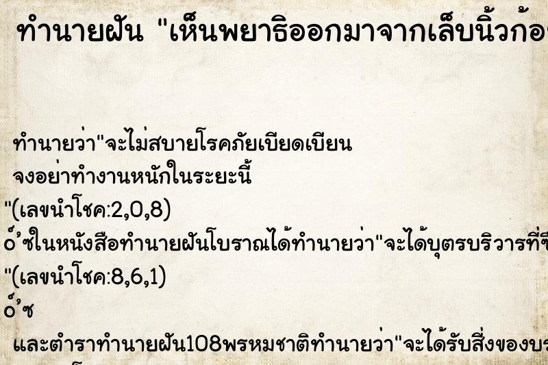 ทำนายฝัน เห็นพยาธิออกมาจากเล็บนิ้วก้อย ทำนายฝัน เห็นพยาธิออกมาจากเล็บนิ้วก้อย