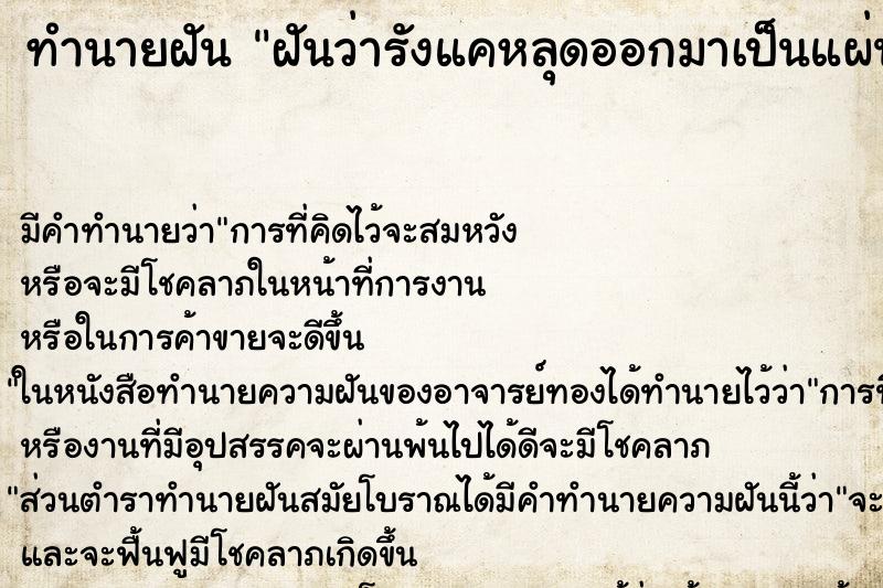 ทำนายฝัน ฝันว่ารังแคหลุดออกมาเป็นแผ่นใหญ่ ทำนายฝัน ฝันว่ารังแคหลุดออกมาเป็นแผ่นใหญ่