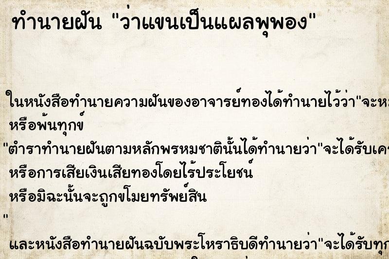 ทำนายฝันทำนายฝันว่าแขนเป็นแผลพุพอง
