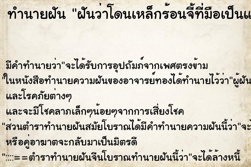 ทำนายฝัน ฝันว่าโดนเหล็กร้อนจี้ที่มือเป็นแผล ทำนายฝัน ฝันว่าโดนเหล็กร้อนจี้ที่มือเป็นแผล