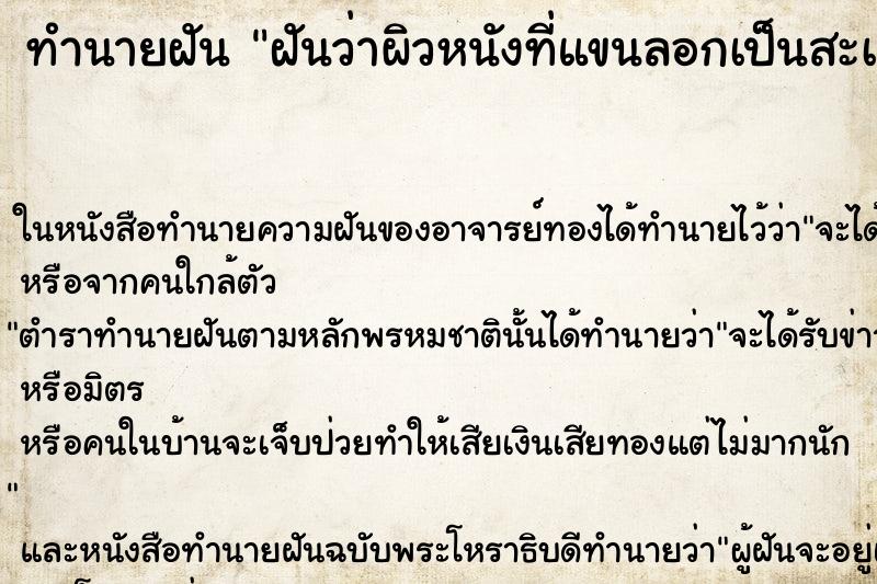 ทำนายฝันทำนายฝันฝันว่าผิวหนังที่แขนลอกเป็นสะเก็ด