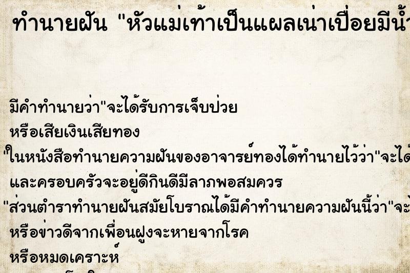 ทำนายฝัน หัวแม่เท้าเป็นแผลเน่าเปื่อยมีน้ำเหลือง ทำนายฝัน หัวแม่เท้าเป็นแผลเน่าเปื่อยมีน้ำเหลือง