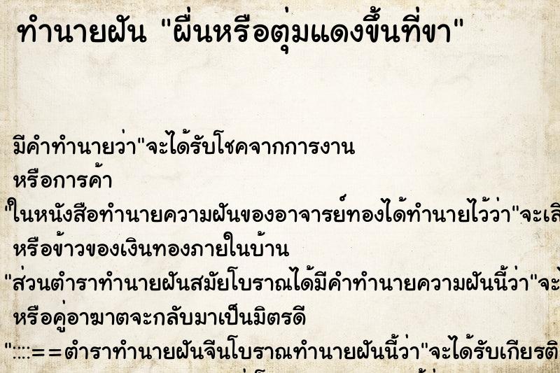 ทำนายฝัน ผื่นหรือตุ่มแดงขึ้นที่ขา ทำนายฝัน ผื่นหรือตุ่มแดงขึ้นที่ขา
