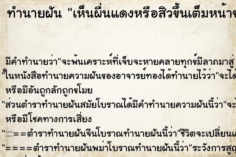 ทำนายฝัน เห็นผื่นแดงหรือสิวขึ้นเต็มหน้าของตัวเอง ทำนายฝัน เห็นผื่นแดงหรือสิวขึ้นเต็มหน้าของตัวเอง