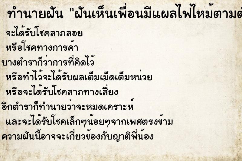 ทำนายฝันฝันเห็นเพื่อนมีแผลไฟไหม้ตามตัว ทำนายฝันทำนายฝันฝันเห็นเพื่อนมีแผลไฟไหม้ตามตัว