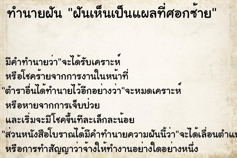 ทำนายฝันฝันเห็นเป็นแผลที่ศอกซ้าย ทำนายฝันทำนายฝันฝันเห็นเป็นแผลที่ศอกซ้าย