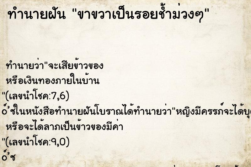 ทำนายฝัน ขาขวาเป็นรอยช้ำม่วงๆ ทำนายฝัน ขาขวาเป็นรอยช้ำม่วงๆ