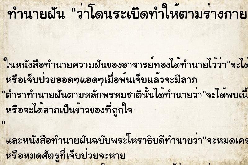 ทำนายฝันทำนายฝันว่าโดนระเบิดทำให้ตามร่างกายเป็นแผล