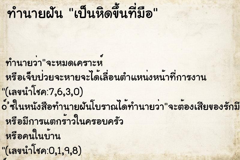 ทำนายฝันทำนายฝันเป็นหิดขึ้นที่มือ