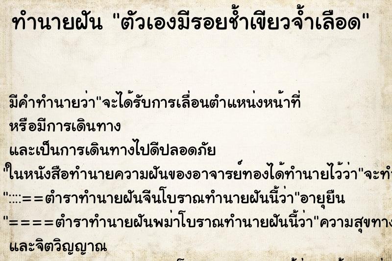 ทำนายฝัน ตัวเองมีรอยช้ำเขียวจ้ำเลือด ทำนายฝัน ตัวเองมีรอยช้ำเขียวจ้ำเลือด
