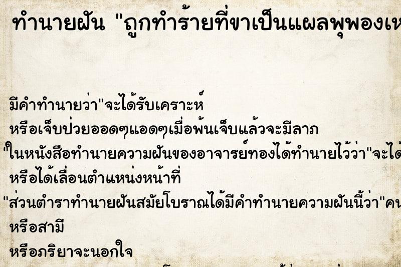 ทำนายฝันถูกทำร้ายที่ขาเป็นแผลพุพองเหวอะหวะ ทำนายฝันทำนายฝันถูกทำร้ายที่ขาเป็นแผลพุพองเหวอะหวะ