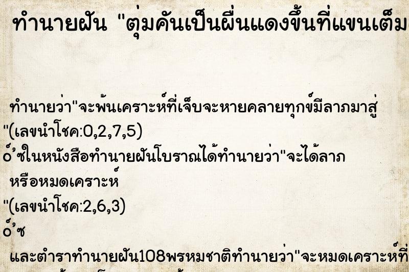 ทำนายฝัน ตุ่มคันเป็นผื่นแดงขึ้นที่แขนเต็มเลย ทำนายฝัน ตุ่มคันเป็นผื่นแดงขึ้นที่แขนเต็มเลย