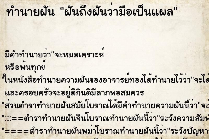 ทำนายฝัน ฝันถึงฝันว่ามือเป็นแผล ทำนายฝัน ฝันถึงฝันว่ามือเป็นแผล