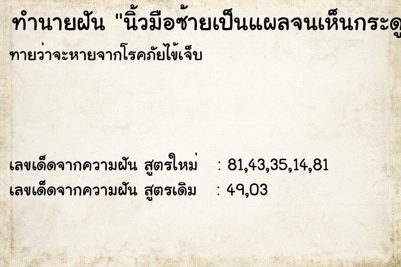 ทำนายฝัน นิ้วมือซ้ายเป็นแผลจนเห็นกระดูก ทำนายฝัน นิ้วมือซ้ายเป็นแผลจนเห็นกระดูก