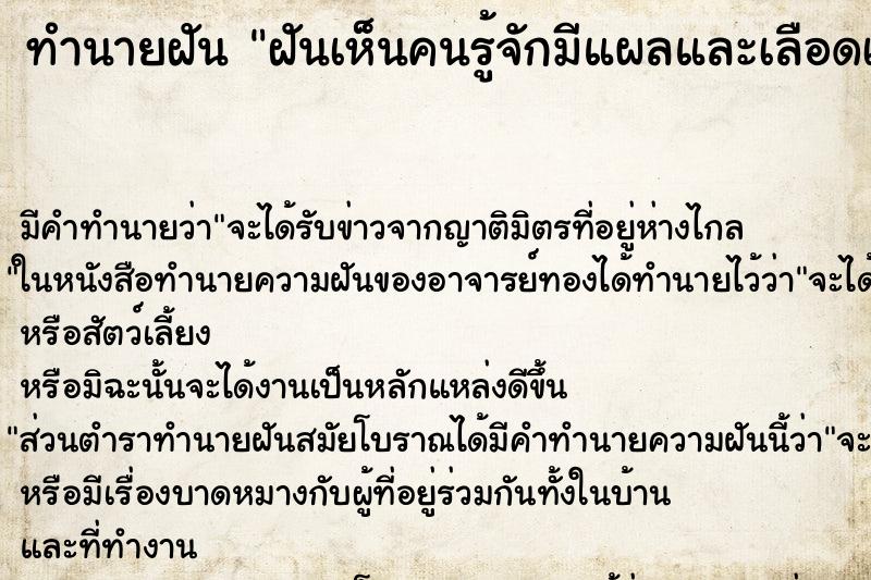 ทำนายฝันฝันเห็นคนรู้จักมีแผลและเลือดเต็มหน้าเลย ทำนายฝันทำนายฝันฝันเห็นคนรู้จักมีแผลและเลือดเต็มหน้าเลย
