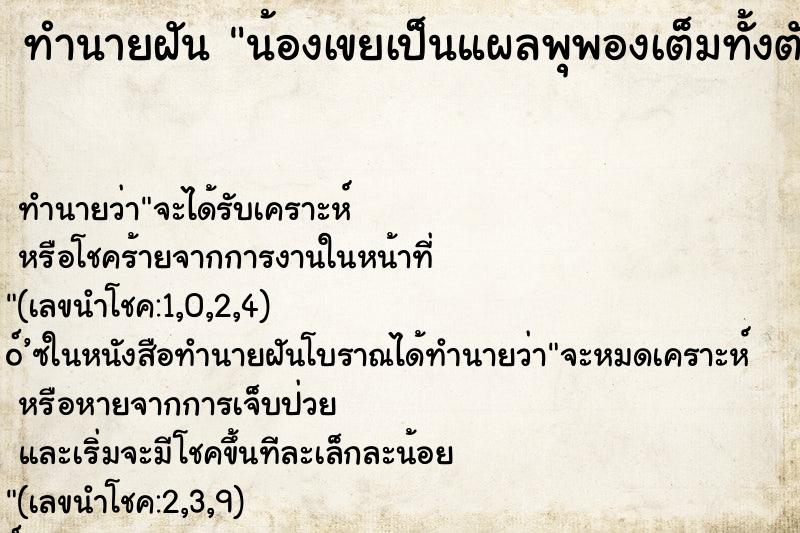 ทำนายฝันน้องเขยเป็นแผลพุพองเต็มทั้งตัว ทำนายฝันทำนายฝันน้องเขยเป็นแผลพุพองเต็มทั้งตัว