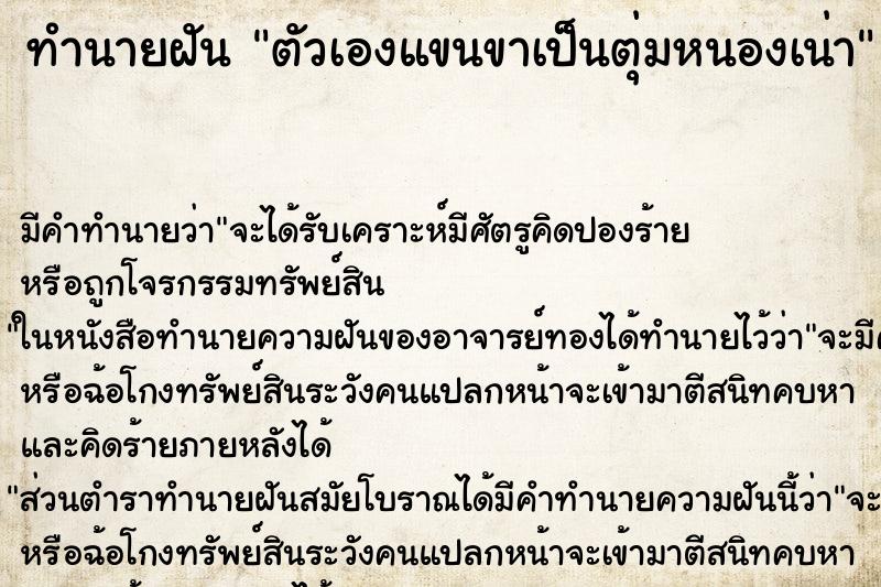 ทำนายฝันตัวเองแขนขาเป็นตุ่มหนองเน่า ทำนายฝันทำนายฝันตัวเองแขนขาเป็นตุ่มหนองเน่า