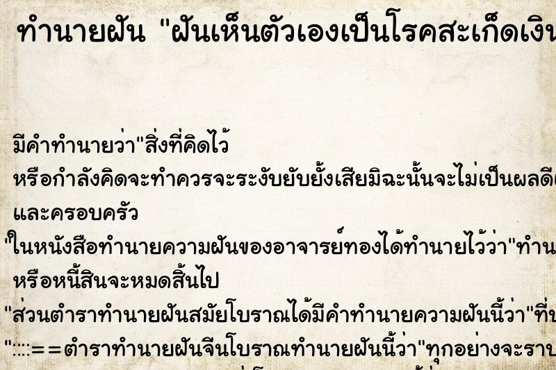 ทำนายฝัน ฝันเห็นตัวเองเป็นโรคสะเก็ดเงิน ทำนายฝัน ฝันเห็นตัวเองเป็นโรคสะเก็ดเงิน