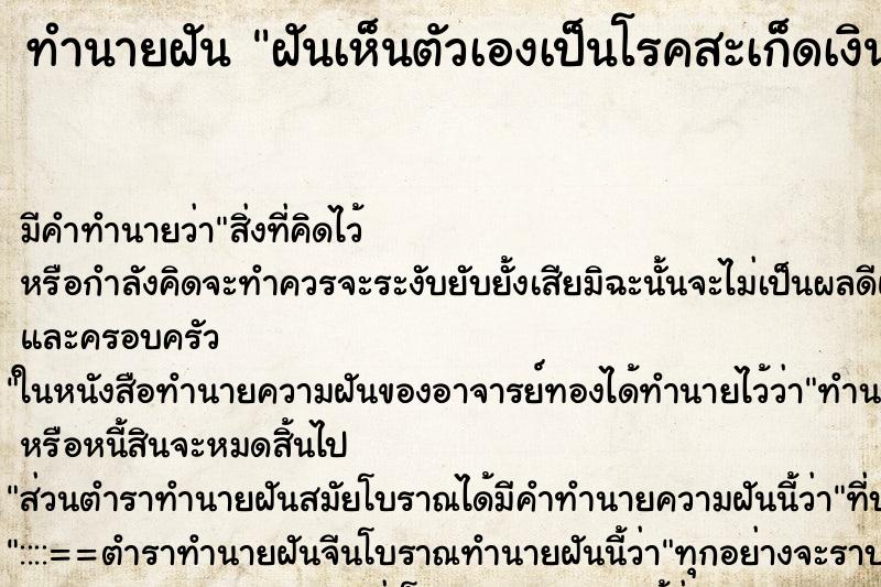 ทำนายฝัน ฝันเห็นตัวเองเป็นโรคสะเก็ดเงิน ตำราโบราณ แม่นที่สุดในโลก