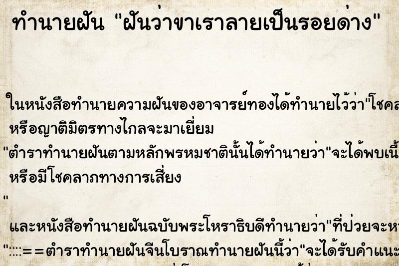 ทำนายฝันทำนายฝันฝันว่าขาเราลายเป็นรอยด่าง
