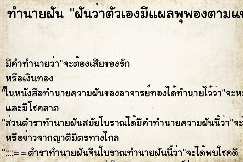 ทำนายฝันฝันว่าตัวเองมีแผลพุพองตามแขนขามากมาย ทำนายฝันทำนายฝันฝันว่าตัวเองมีแผลพุพองตามแขนขามากมาย