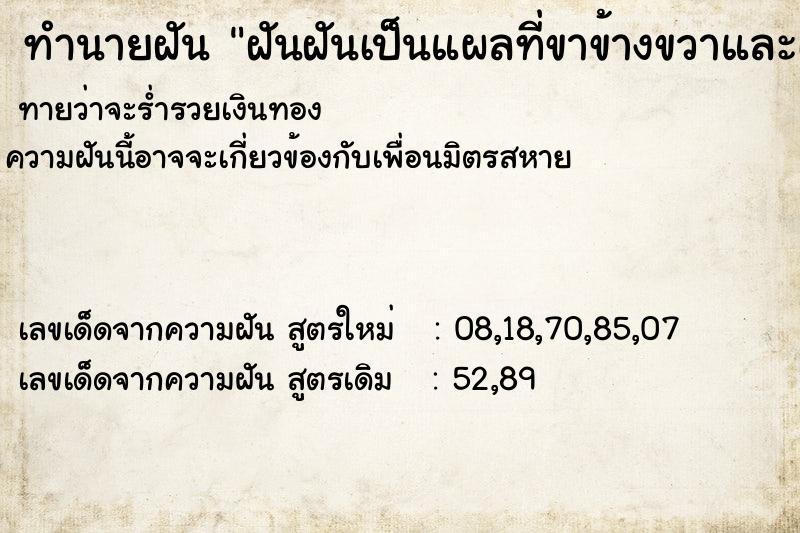 ทำนายฝันทำนายฝันฝันฝันเป็นแผลที่ขาข้างขวาและเย็บแผล