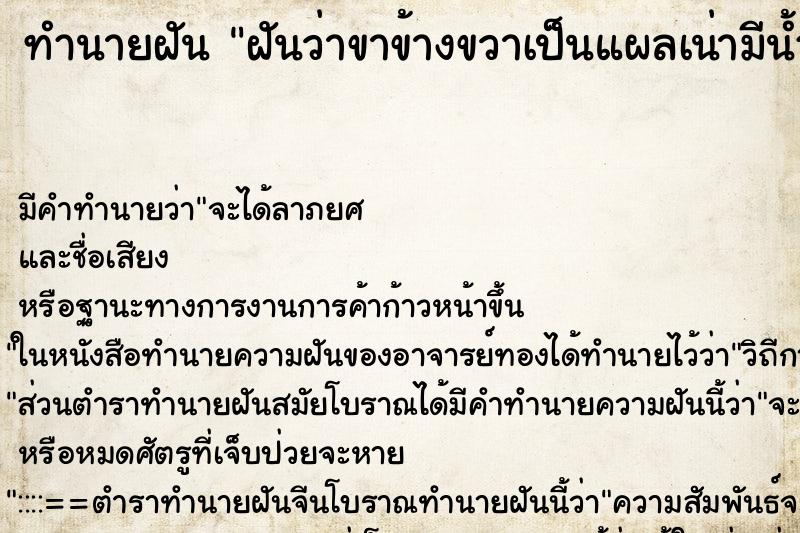 ทำนายฝัน ฝันว่าขาข้างขวาเป็นแผลเน่ามีน้ำเหลือง ทำนายฝัน ฝันว่าขาข้างขวาเป็นแผลเน่ามีน้ำเหลือง
