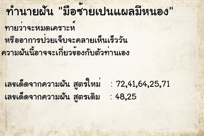 ทำนายฝันมือซ้ายเปนแผลมีหนอง ทำนายฝันทำนายฝันมือซ้ายเปนแผลมีหนอง