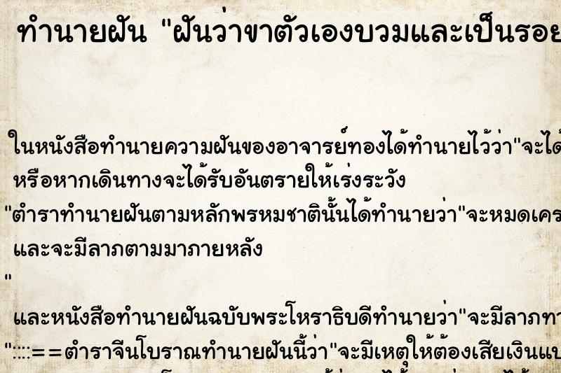 ทำนายฝันฝันว่าขาตัวเองบวมและเป็นรอยช้ำสีเขียวเป็นป้านๆเลย ทำนายฝันทำนายฝันฝันว่าขาตัวเองบวมและเป็นรอยช้ำสีเขียวเป็นป้านๆเลย