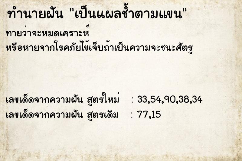 ทำนายฝันเป็นแผลช้ำตามแขน ทำนายฝันทำนายฝันเป็นแผลช้ำตามแขน