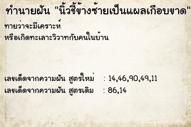 ทำนายฝันนิ้วชี้ข้างซ้ายเป็นแผลเกือบขาด ทำนายฝันทำนายฝันนิ้วชี้ข้างซ้ายเป็นแผลเกือบขาด