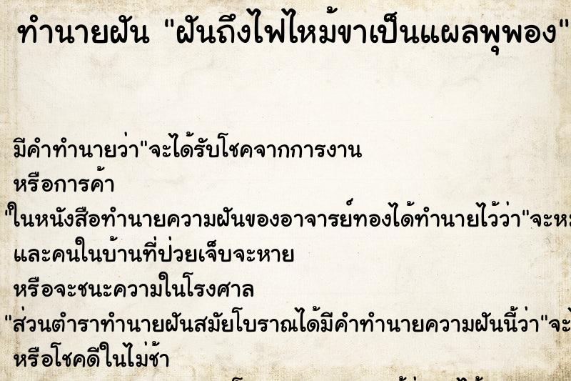 ทำนายฝัน ฝันถึงไฟไหม้ขาเป็นแผลพุพอง ทำนายฝัน ฝันถึงไฟไหม้ขาเป็นแผลพุพอง