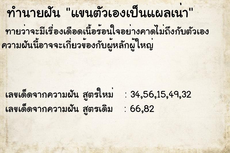 ทำนายฝัน แขนตัวเองเป็นแผลเน่า ทำนายฝัน แขนตัวเองเป็นแผลเน่า