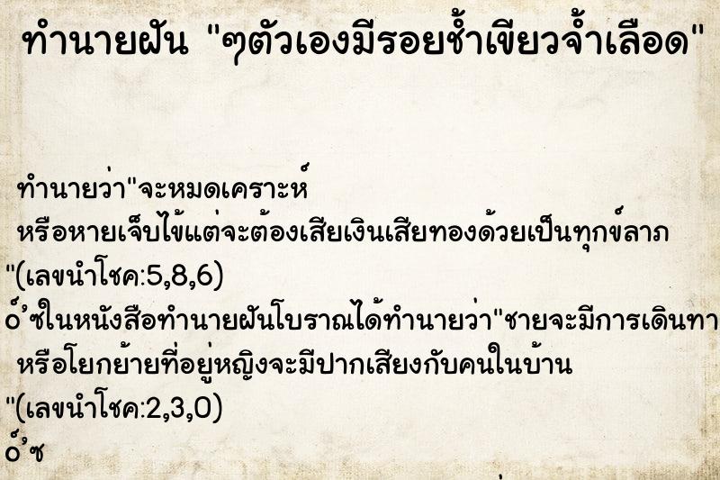 ทำนายฝันๆตัวเองมีรอยช้ำเขียวจ้ำเลือด ทำนายฝันทำนายฝันๆตัวเองมีรอยช้ำเขียวจ้ำเลือด