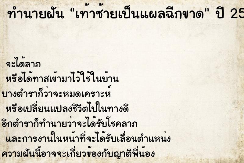 ทำนายฝันเท้าซ้ายเป็นแผลฉีกขาด ทำนายฝันทำนายฝันเท้าซ้ายเป็นแผลฉีกขาด