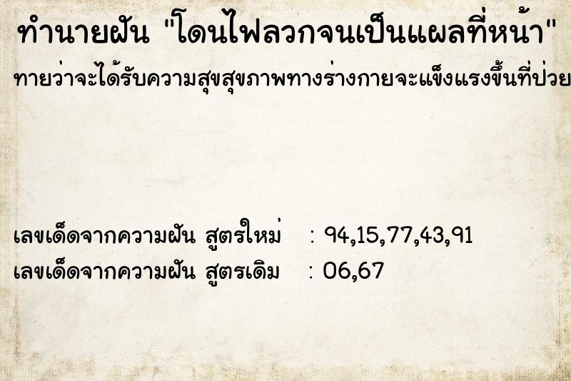 ทำนายฝันโดนไฟลวกจนเป็นแผลที่หน้า ทำนายฝันทำนายฝันโดนไฟลวกจนเป็นแผลที่หน้า