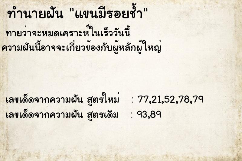 ทำนายฝันทำนายฝันแขนมีรอยช้ำ